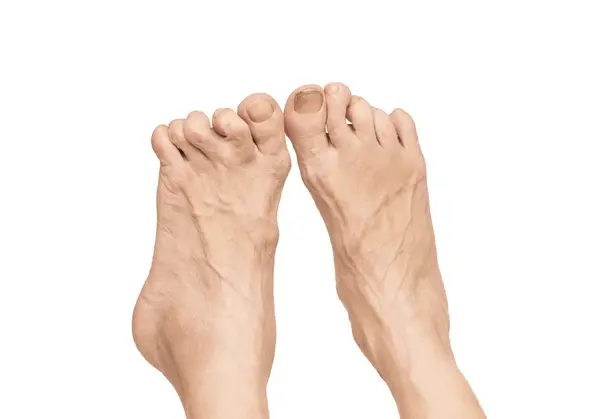 arthritic foot and ankle care in harrison and mountain home, ar