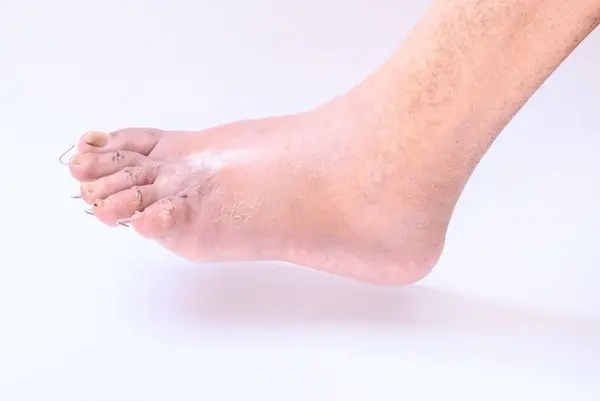 foot surgery and complex reconstruction procedures in harrison and mountain home, ar