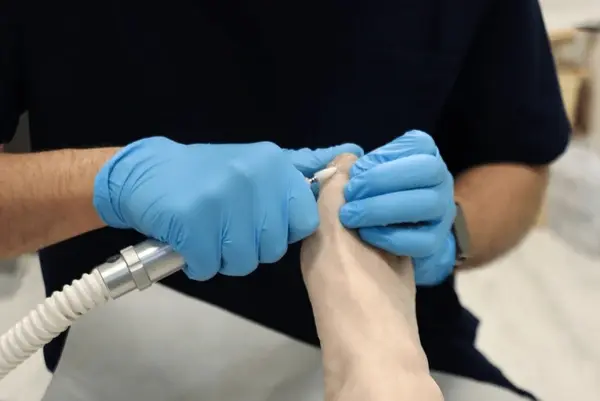 fungal toenail treatment near you